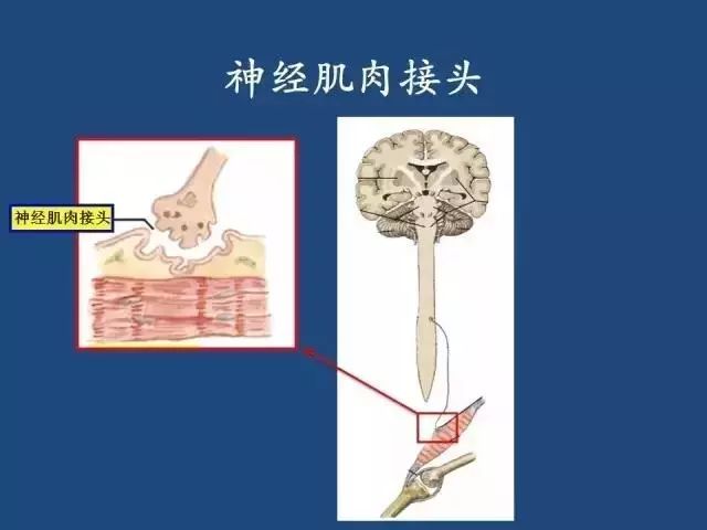 但这种感觉会随着休息调整而逐渐消失,与重症肌无力导致的肌