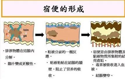 益生菌肠道健康是人体健康的第一要素