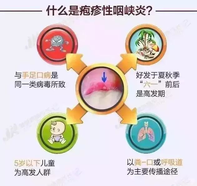 还以为是手足口?疱疹性咽颊炎爆发,这4种症状需马上就医