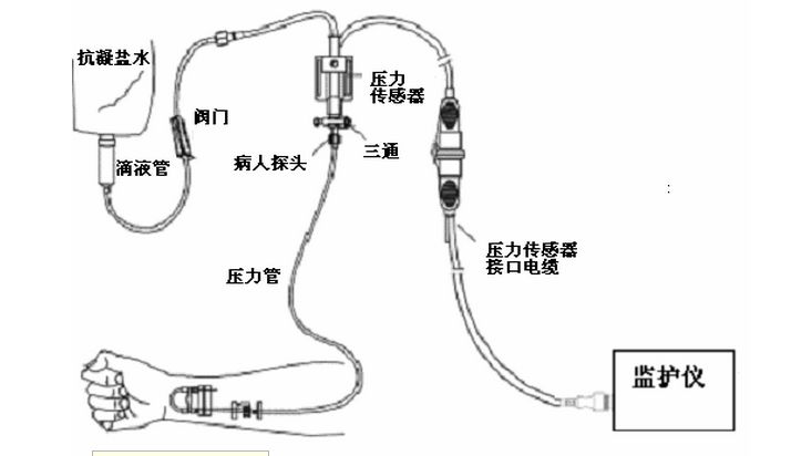 (2)侧卧位:只要压力传感器与心脏水平平齐,无论在哪侧上肢进行动脉压