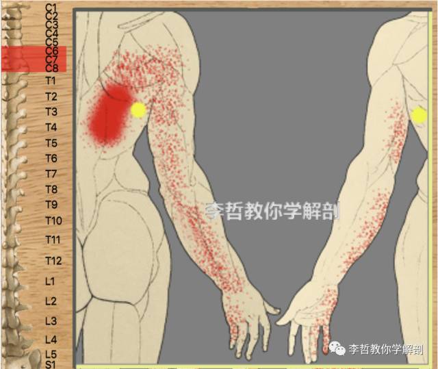 内衣勒的肋骨疼_肋骨外翻图片(3)