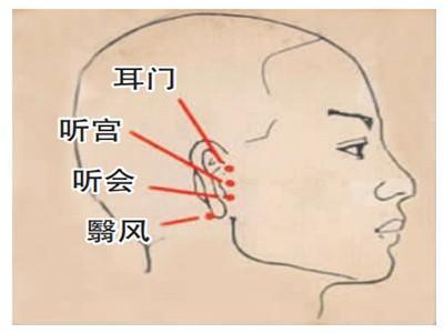 耳门穴位置图和功效作用