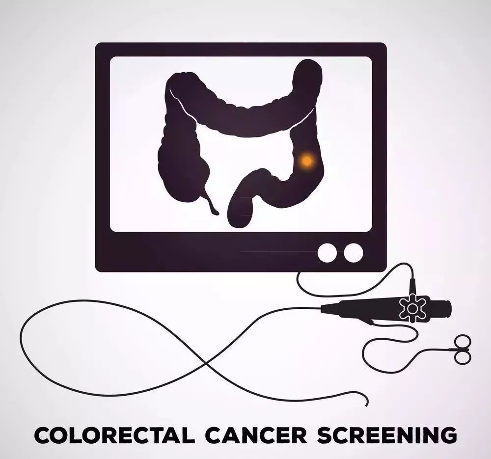 肠镜查癌40岁应该做50岁以上必须做