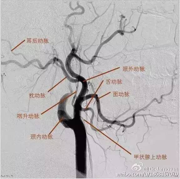 面动脉,颞浅动脉,上颌动脉,枕动脉,耳后动脉,咽升动脉等沿颈总动脉走