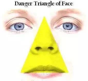 面部危险三角