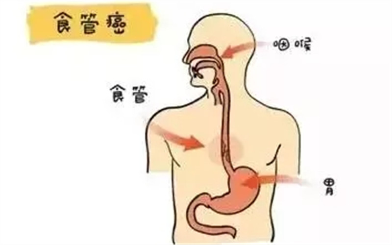 癌症病人口水减少_癌症病人图片(3)