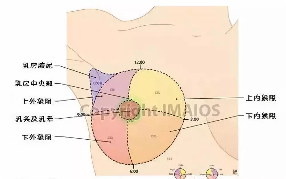 虽然乳腺癌多发于腋窝和内乳这两处淋巴引流区,但临床证明,频繁刮腋毛