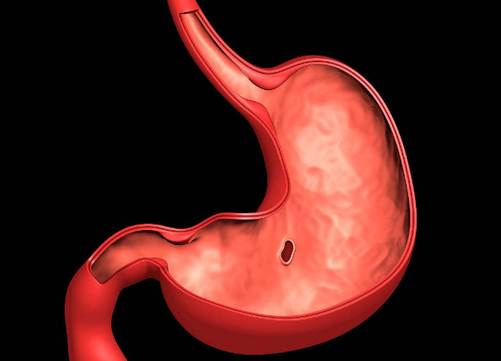 它的人的胃黏膜内"横行霸道",不去重视,胃迟早要癌变