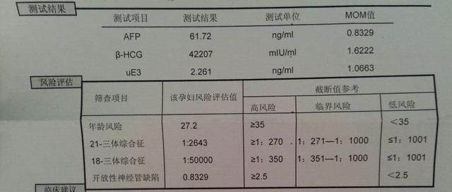 唐氏筛查的原理_每20分钟就有一个唐氏儿出生 孕妈妈产前筛查必不可少(3)