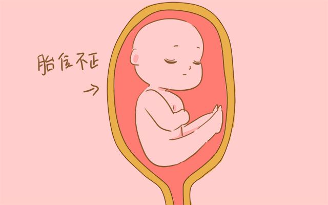 孕检时发现胎位异常,孕妈不要慌,这几个方法帮助胎儿恢复正常胎位