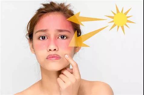 晒伤的实质,就是皮肤受紫外线中uvb波段影响,而引发的急性红斑效应.