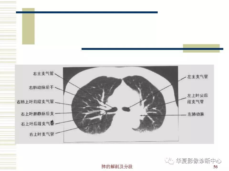 肺部解剖与分段