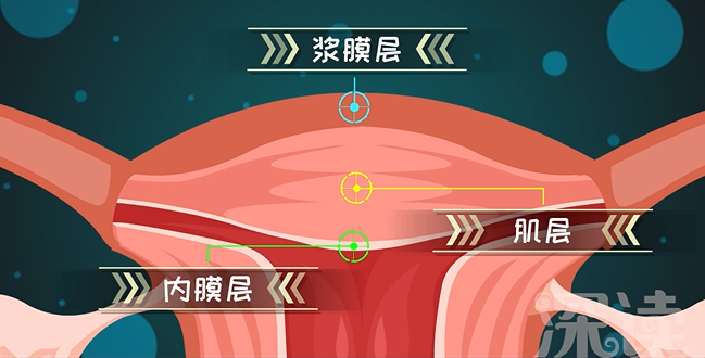 聚焦子宫壁,由内向外分别是内膜层,肌层和浆膜层,这三层都可能长肌瘤.