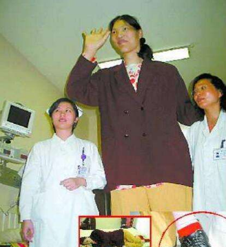世界上最高的女人,中国姚德芬身高2.36米