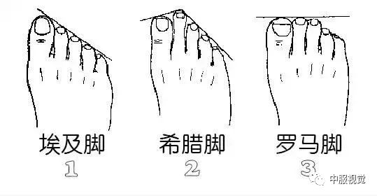 脚型分类