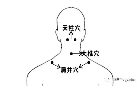 【慢性支气管炎取穴】大椎,肺俞,膻中,脾俞,丰隆.