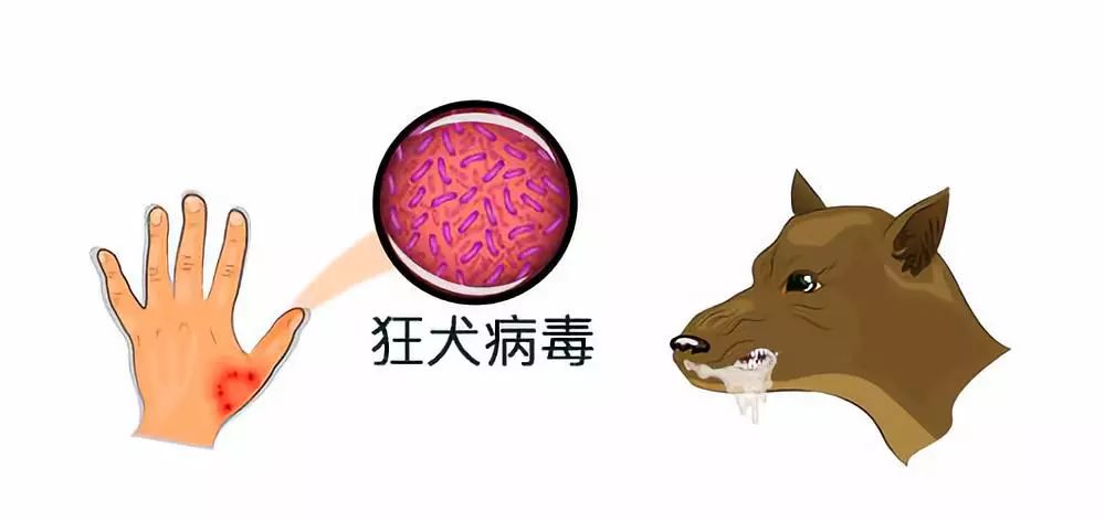 狂犬病致死率100这些救命知识一定要早知道