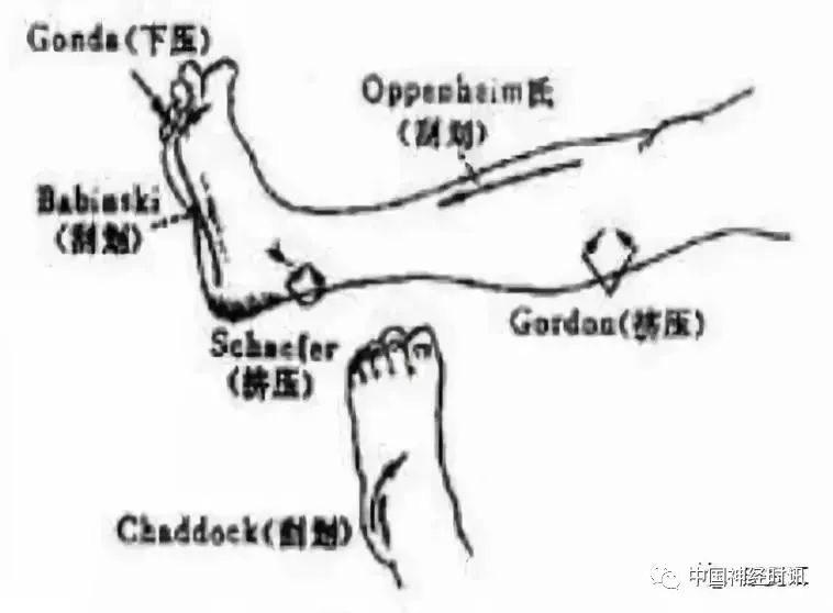 8,罗索里莫(rossolimo)征 4,强握反射 自主神经功能检查 一,一般检查