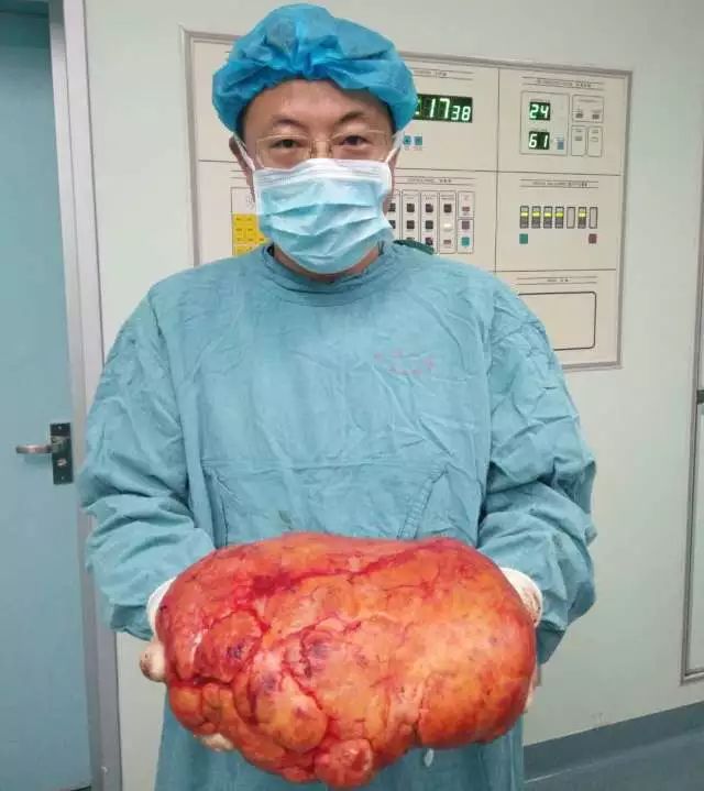 omg他的肾脏里长了一个8斤重的瘤子