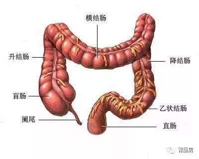 结肠镜病理报告怎么解读这篇讲的很到位