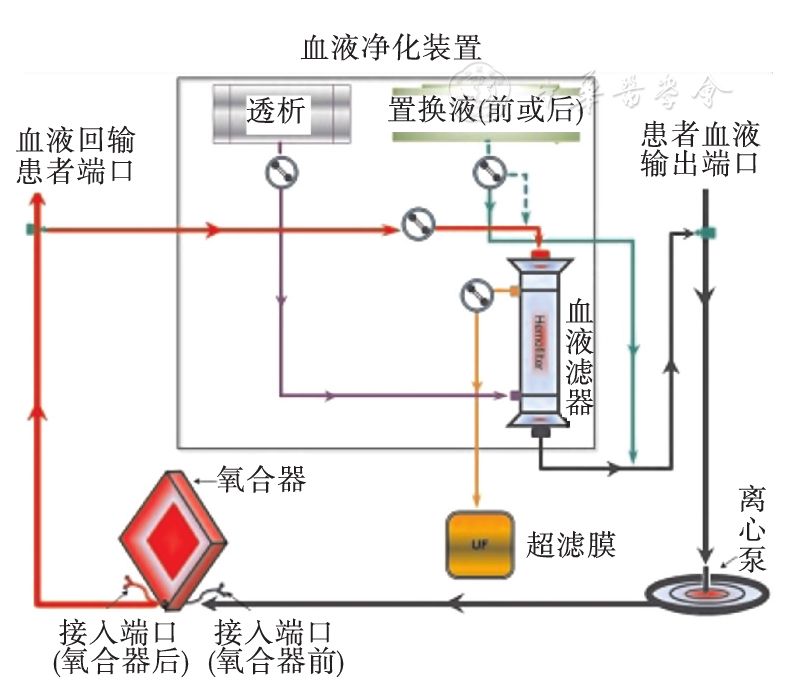 crrt从ecmo氧合器后引血,经滤器滤过后血液回到ecmo动力泵前