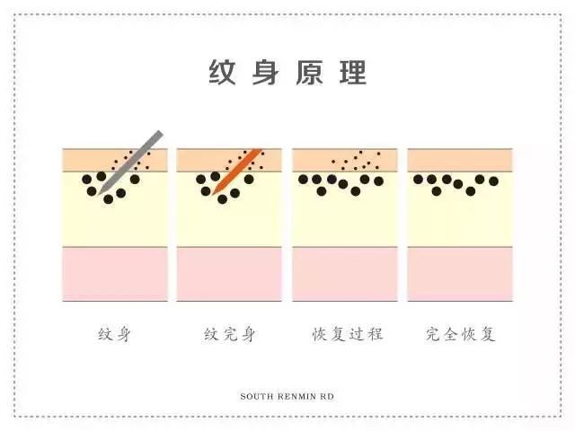 纹身脱皮很痒怎么办