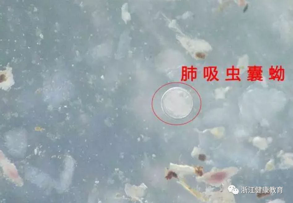 一只溪蟹感染30个肺吸虫!这样的"美食",你还敢吃?