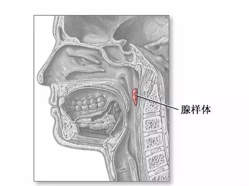 腺样体肥大是个什么鬼问题一关于打呼噜