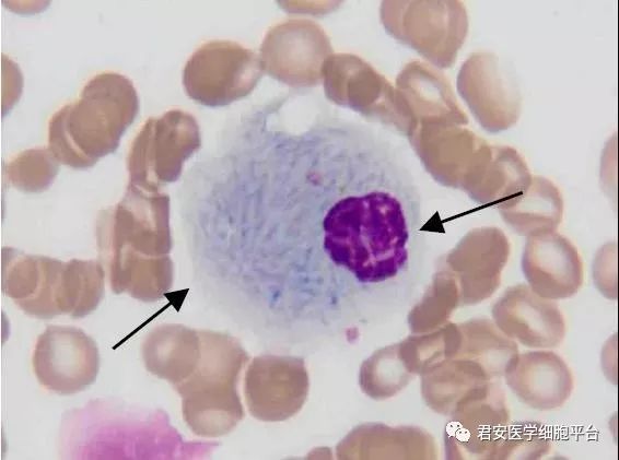 看图识细胞之"卫生部 2018 年第1 次血细胞形态学质控"