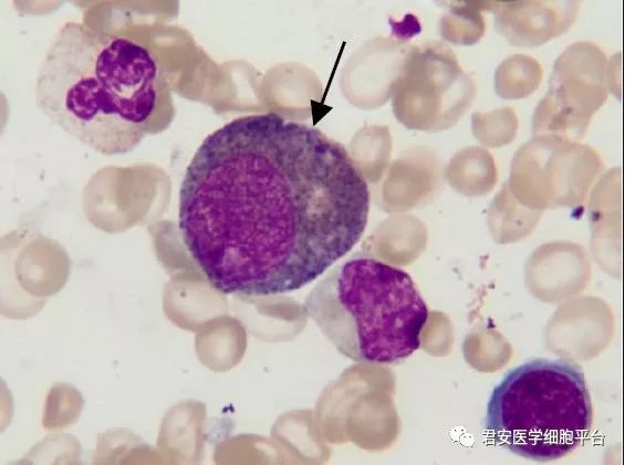 看图识细胞之卫生部2018年第1次血细胞形态学质控