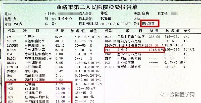 血小板计数差距如此之大,你该报哪一个?