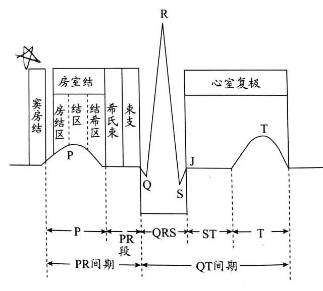 心电图复习全攻略