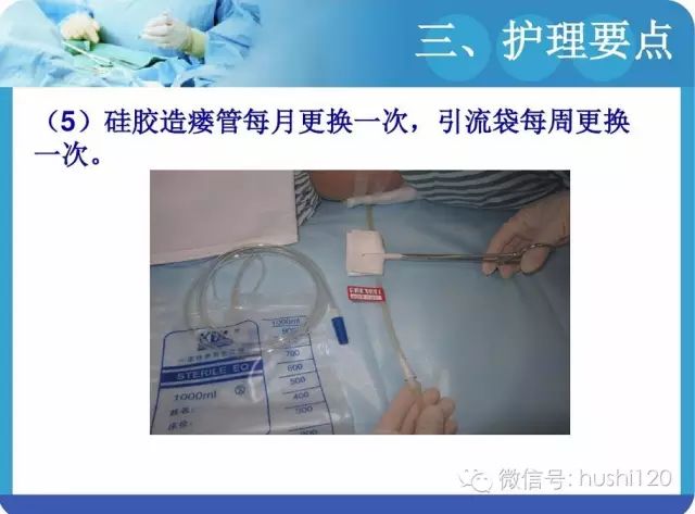 ppt:肾穿刺造瘘术的护理