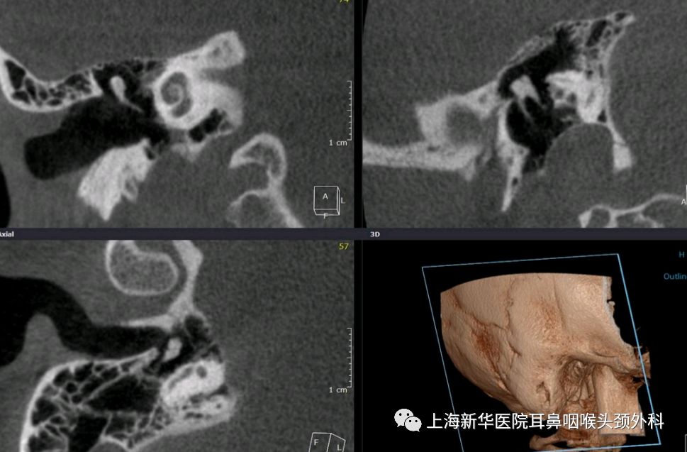 cbct为患者带来更高效更安全的就诊体验