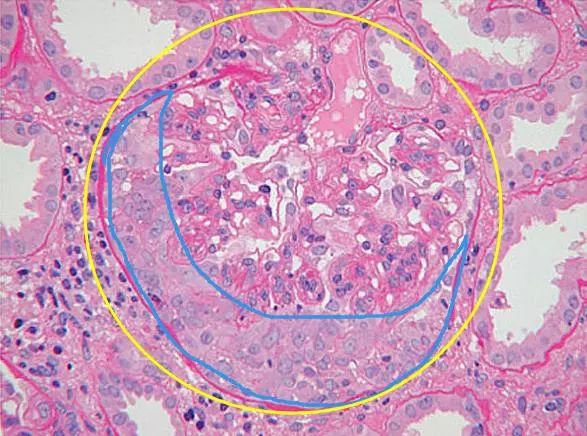 从肾脏中取出肾小球,放在显微镜下(如下图).