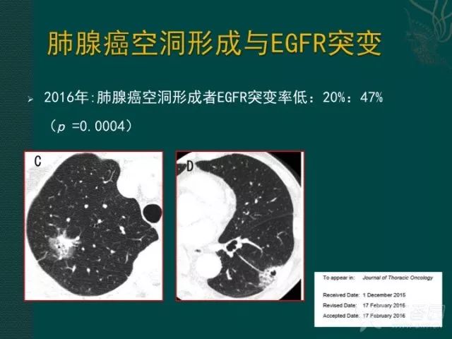 看完这篇,晋级空洞型肺癌诊断高手