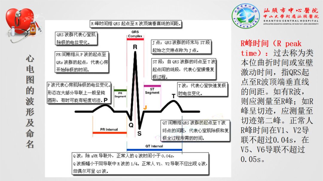 心肌梗死,心律失常,异常心电图大盘点!