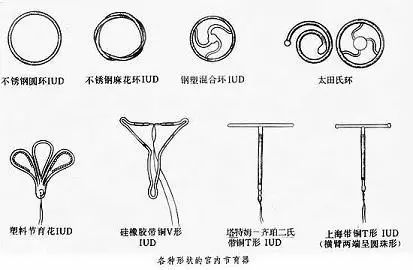 节育环是一种放置在子宫腔内的避孕装置,由于初期使用的装置多是环状