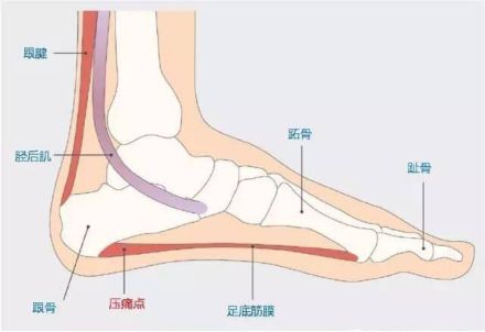 足跟痛,足心痛,别只考虑筋膜和肌肉,神经卡压最容易被