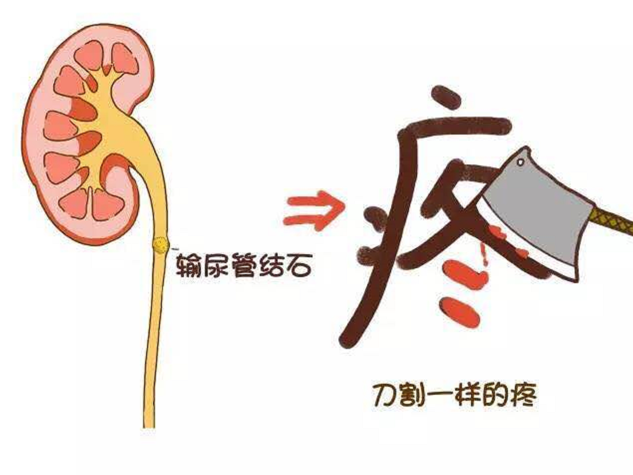 泌尿系统疾病病人的护理. - ppt download