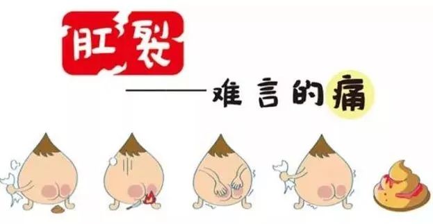 哺乳期肛裂怎么办