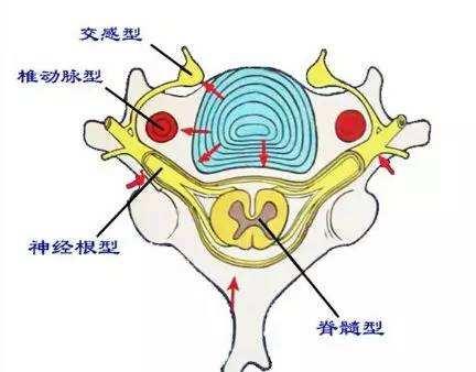 病人口水多 手麻木_病人住院图片(3)