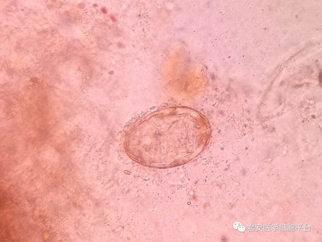 日本血吸虫卵椭圆形(70-100)um x(50-65)um,淡黄色,卵壳厚薄均匀,无
