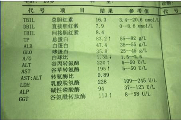 转氨酶高于这个值是肝炎的早期症状!养肝补两物,降酶