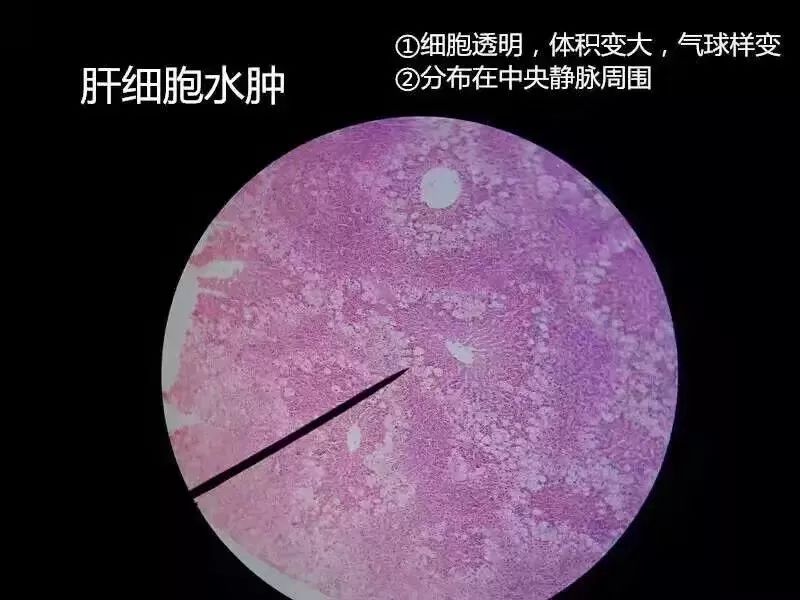 病理学切片库