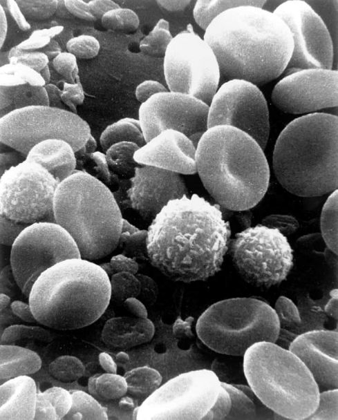 扫描电镜下的血细胞