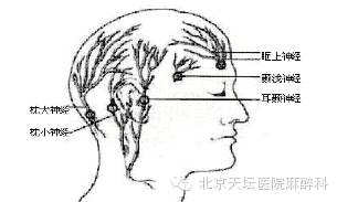 术中唤醒麻醉一头部神经阻滞