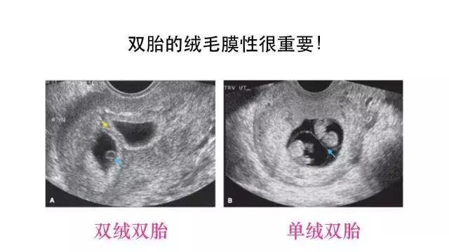 孕24周羊水偏少怎么办