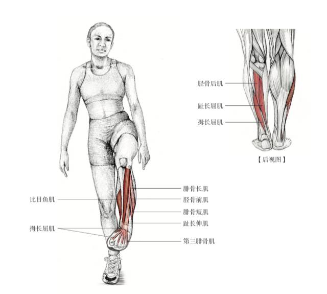 胫骨内侧疼痛综合征(胫骨疼痛,小腿疼痛),脚踝扭伤,胫骨后肌肌腱炎