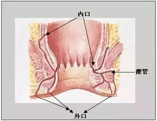 肛瘘是指肛门周围的肉芽肿性管道,也是一种皮肤软组织的炎症性疾病.